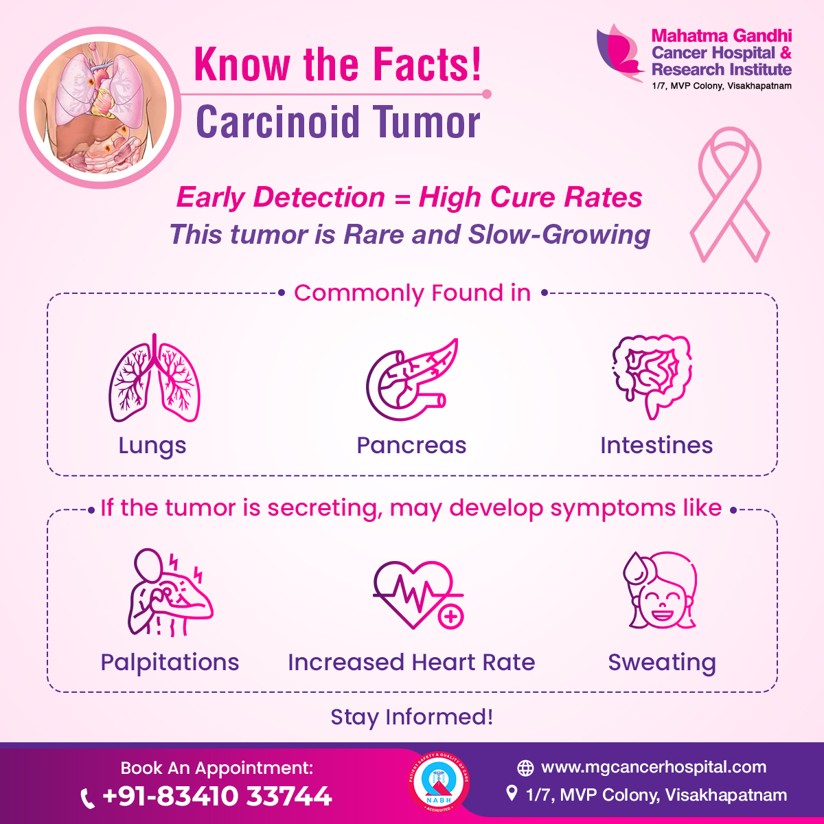 Understand the truth about Carcinoid Tumors! 
Early detection leads to high cure rates. Recognize symptoms, stay informed, and empower yourself against Carcinoid Tumors!
mgcancerhospital.com 

#CarcinoidTumor #NeuroendocrineTumor #CarcinoidAwareness
#NETCancer #RareDisease