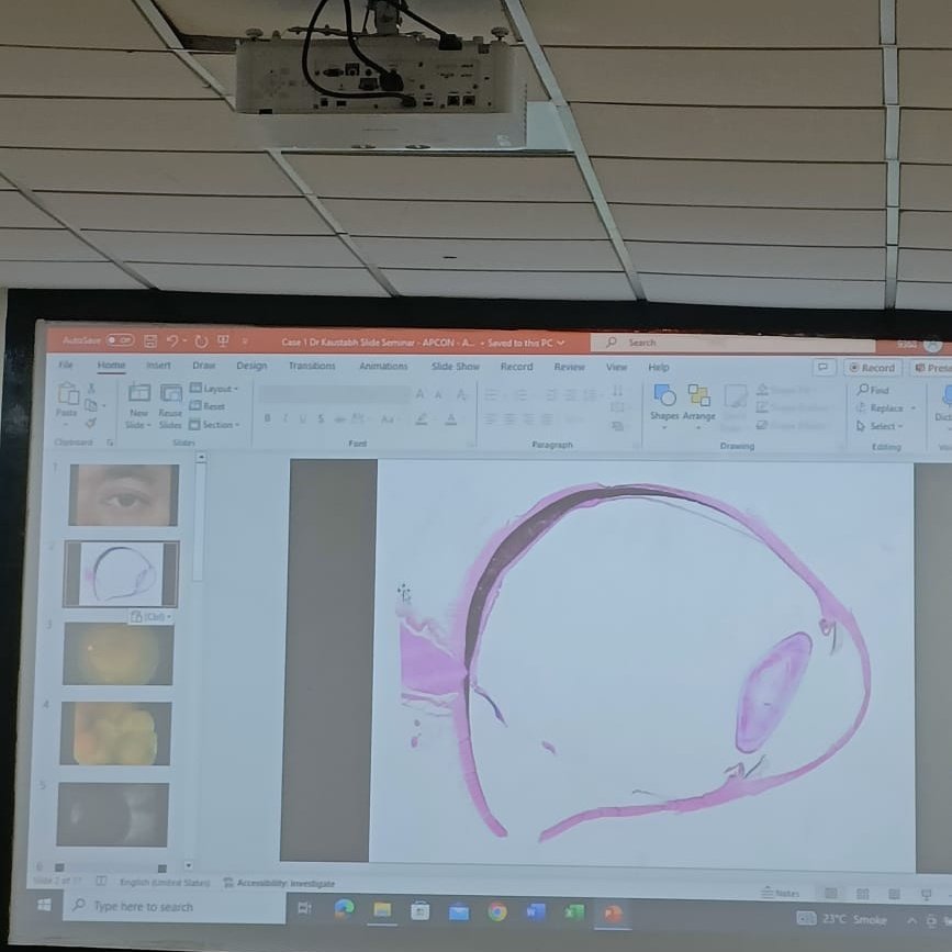 PathSupremacy's tweet image. Keeping an eye on this opthalmology session! @Apcon2023 #APCON2023