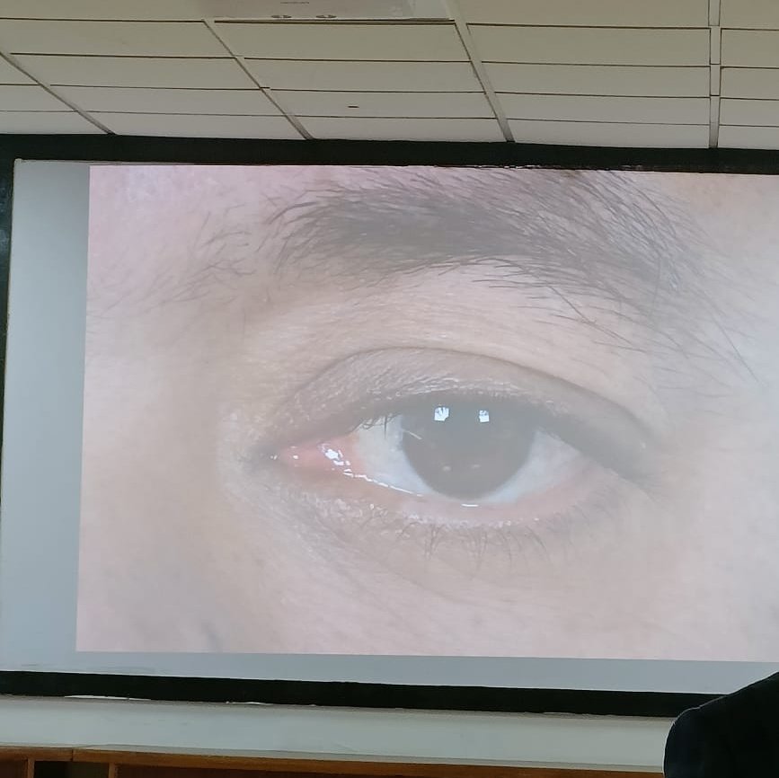 PathSupremacy's tweet image. Keeping an eye on this opthalmology session! @Apcon2023 #APCON2023