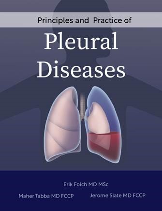 Y C Gary Lee (@ycgarylee) on Twitter photo Delighted to see our chapter with <a href="/arash_badiei/">Arash Badiei</a> on 'The Why & How of Setting up a Pleural Service' in print at the 'Principles and Pracitce of #Pleural Diseases' edited by Drs Erik Folch, Maher Tabba & Jerry Slate. Congratulations! Delighted to see our chapter with <a href="/arash_badiei/">Arash Badiei</a> on 'The Why & How of Setting up a Pleural Service' in print at the 'Principles and Pracitce of #Pleural Diseases' edited by Drs Erik Folch, Maher Tabba & Jerry Slate. Congratulations!