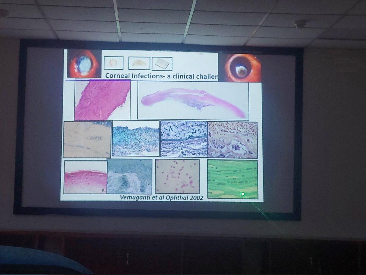 ViralBhanvadia's tweet image. @Apcon2023 ,#APCON2023 ,#eyepath #occularpatho #headneckpath #occularmicrobiology #pathbugs