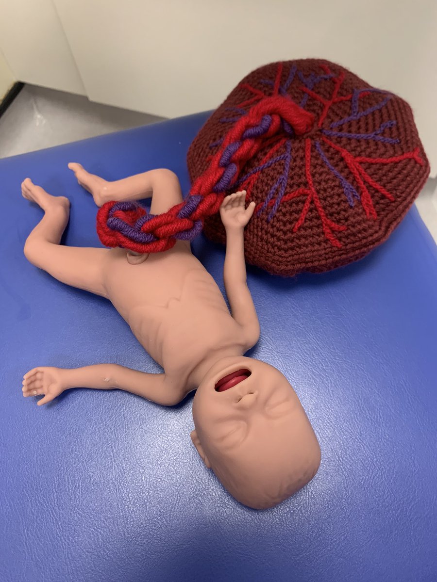 Focus on thermoregulation in a preterm deliv sim 👶🏽🌡️ great learning &amp; discussion 🧠 Do you dry head and put a hat during DCC? Can you facilitate deliv room cuddle when hypothermic? Feat my favourite sim prop…our NICU-nurse-knitted placenta…complete w 2UA/1UV 😍🫀🫶🏾#neotwitter