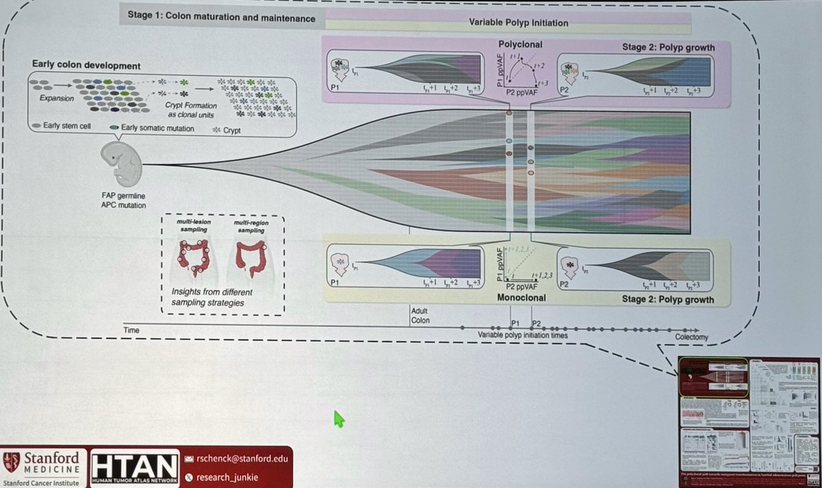 Sandy Anderson (@ara_anderson) on Twitter photo Former student and now <a href="/cncurtis/">Christina Curtis</a> postdoc <a href="/research_junkie/">Ryan O Schenck</a> presents, The polyclonal path towards malignant transformation in familial adenomatous polyposis #AACREvol23 Former student and now <a href="/cncurtis/">Christina Curtis</a> postdoc <a href="/research_junkie/">Ryan O Schenck</a> presents, The polyclonal path towards malignant transformation in familial adenomatous polyposis #AACREvol23