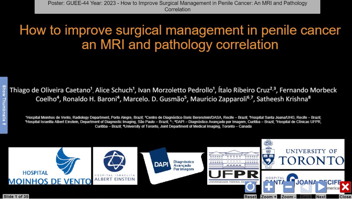 #RSNA23
Contributing again with posters to the biggest radiology event was a satisfaction.
Special thanks to the colleagues of multicenter work on "MRI in penile cancer": R. Baroni, <a href="/mauzappa/">Mauricio Zapparoli, MD MSc</a>, <a href="/SchuchAlice/">Alice Schuch</a>, <a href="/marcelogusmao2/">Marcelo Gusmão</a>, I. Cruz, T. Caetano, <a href="/IvanPedrollo/">Ivan Pedrollo</a> and <a href="/SatheeshToronto/">Satheesh Krishna</a>