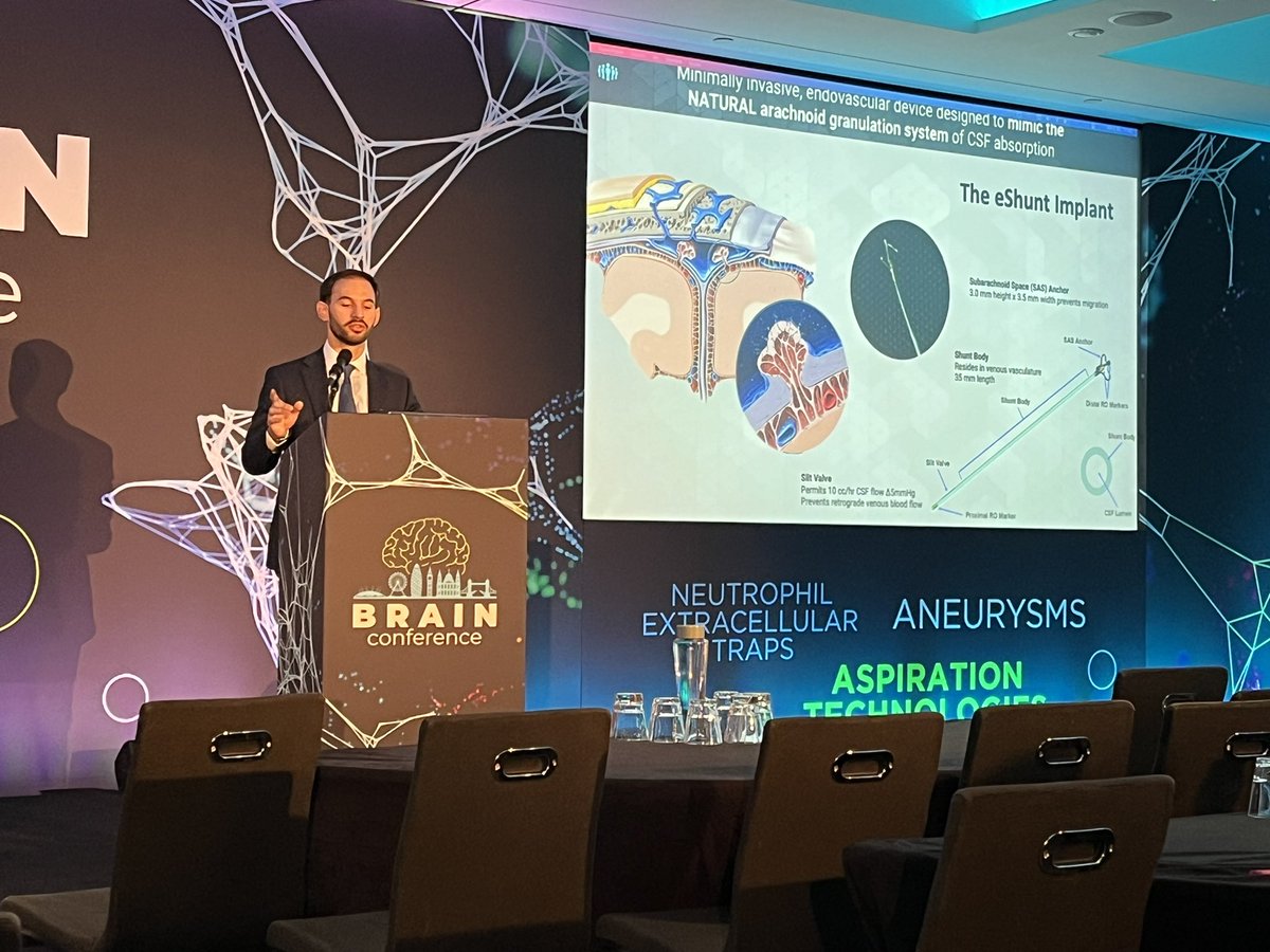 johanna_ospel's tweet photo. Pedro Lylyk talking about a #neurovascular solution for a non-vascular problem @ #BartsBRAINConference. No 🎄-mas jumper but amazing slides😁 https://t.co/nnU2WEqBMM
