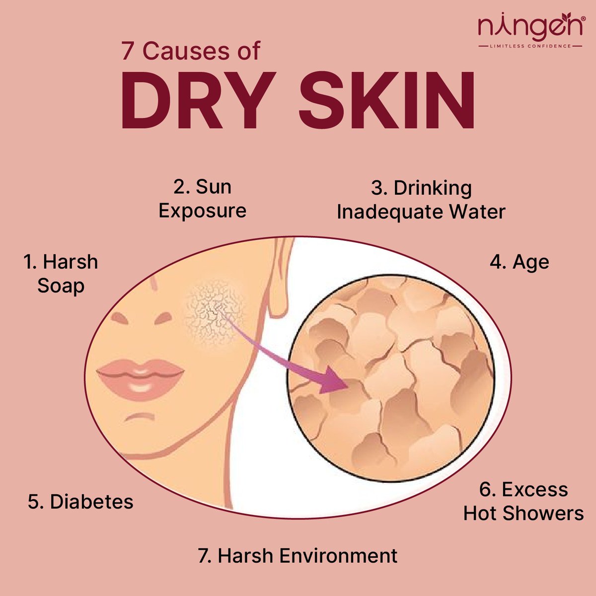 📷No one likes to have dry skin, do you? That's why it is essential to know what causes it to happen for us to avoid having dry and flaky skin.
📷Stay tuned with us to learn more about dry skin.
#Ningen #Phytocosmeceuticals #Skincare #dryskin #dehydration #skindryness