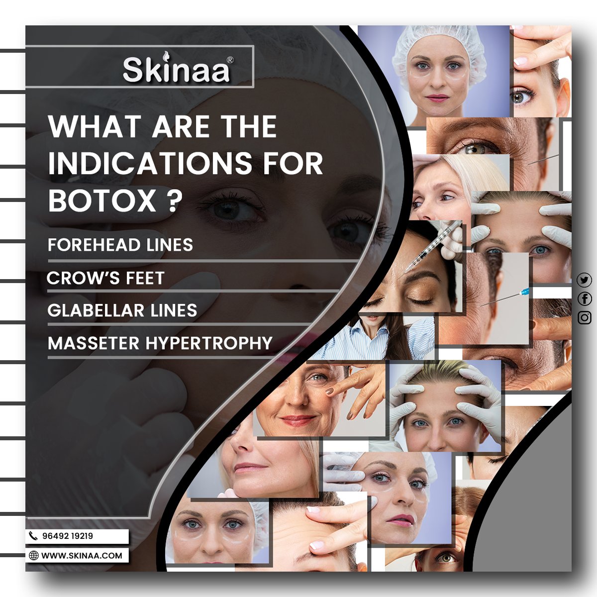 skinaa_clinic's tweet image. When it comes to #determining how much #Botox you need, it's not a one-size-fits-all solution from #treating #finelines and #wrinkles to addressing #muscle-related concerns, Botox can be a versatile #solution.  Schedule a #consultation, start your #personalized Botox experience.