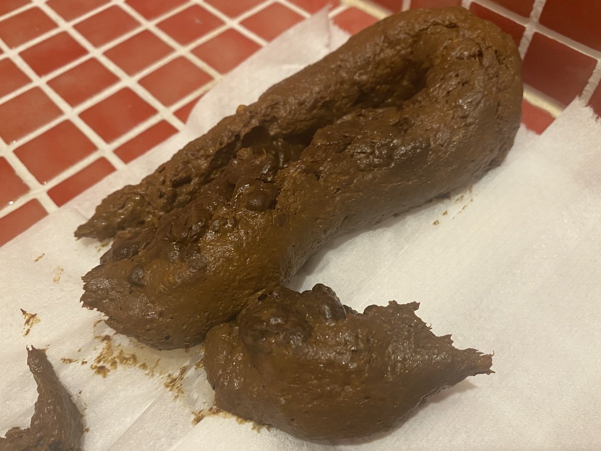 肛門見せつけ脱糞💩