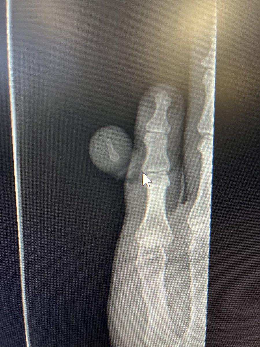 Will Brewster tweet media