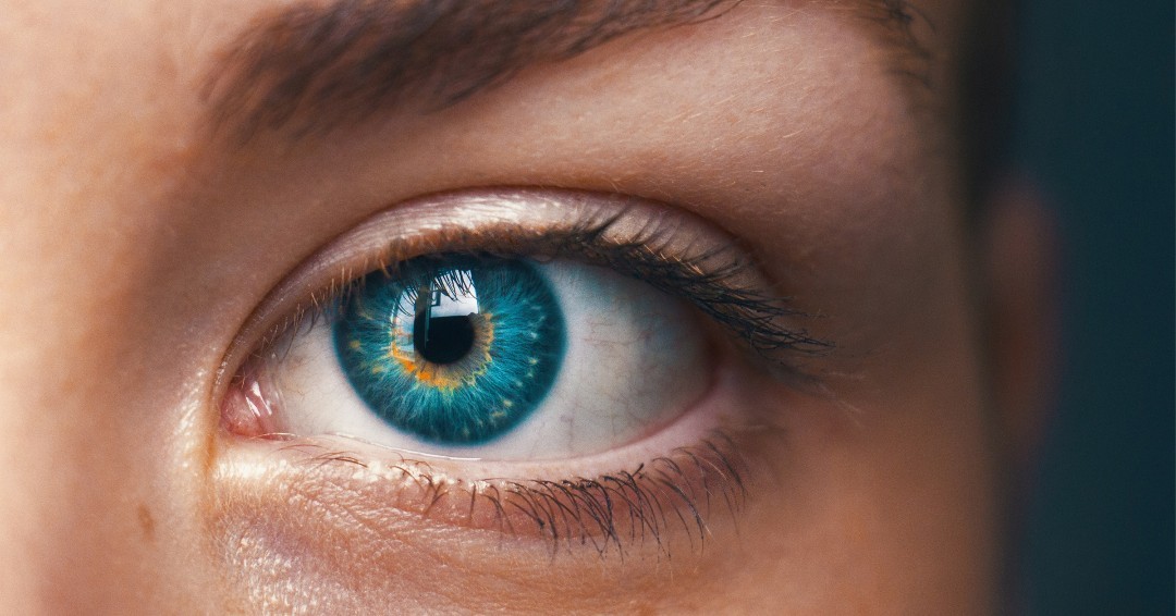 CollegeOptomUK's tweet image. Skin cancer, including basal cell carcinoma, is on the rise. 

Read our new #AcuityJournal to learn about the signs optometrists should look out for and why early intervention is crucial. 

Then take the quiz for 1 CPD point ➡️ coptom.uk/3N1LJkN