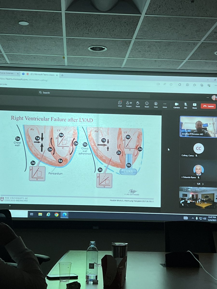 Great talk today by @JonGrinsteinMD hosted by @TJUHospital HF section and @AbbottCardio. Phenomenal teaching about LVAD parameters, hemodynamic assessments, perioperative management, and of course, RV failure. A lot of learning for the @TJHeartFellows. Cc @YevgeniyBr