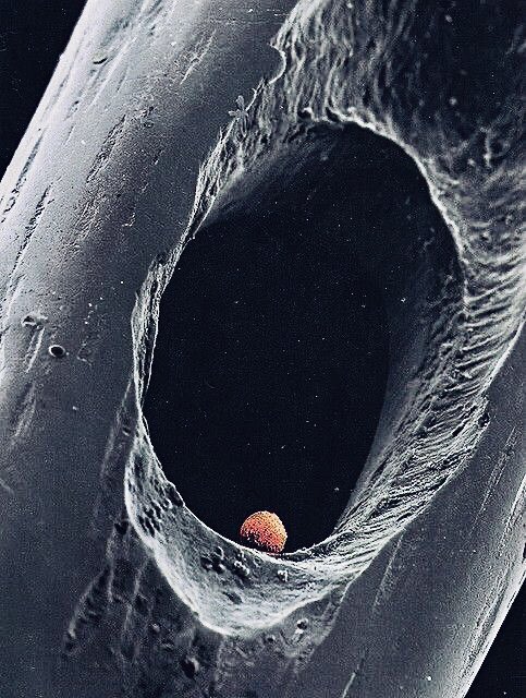 microscopicture's tweet photo. electron microscopic view of a human embryo in the eye of a needle https://t.co/H50LuflF6f