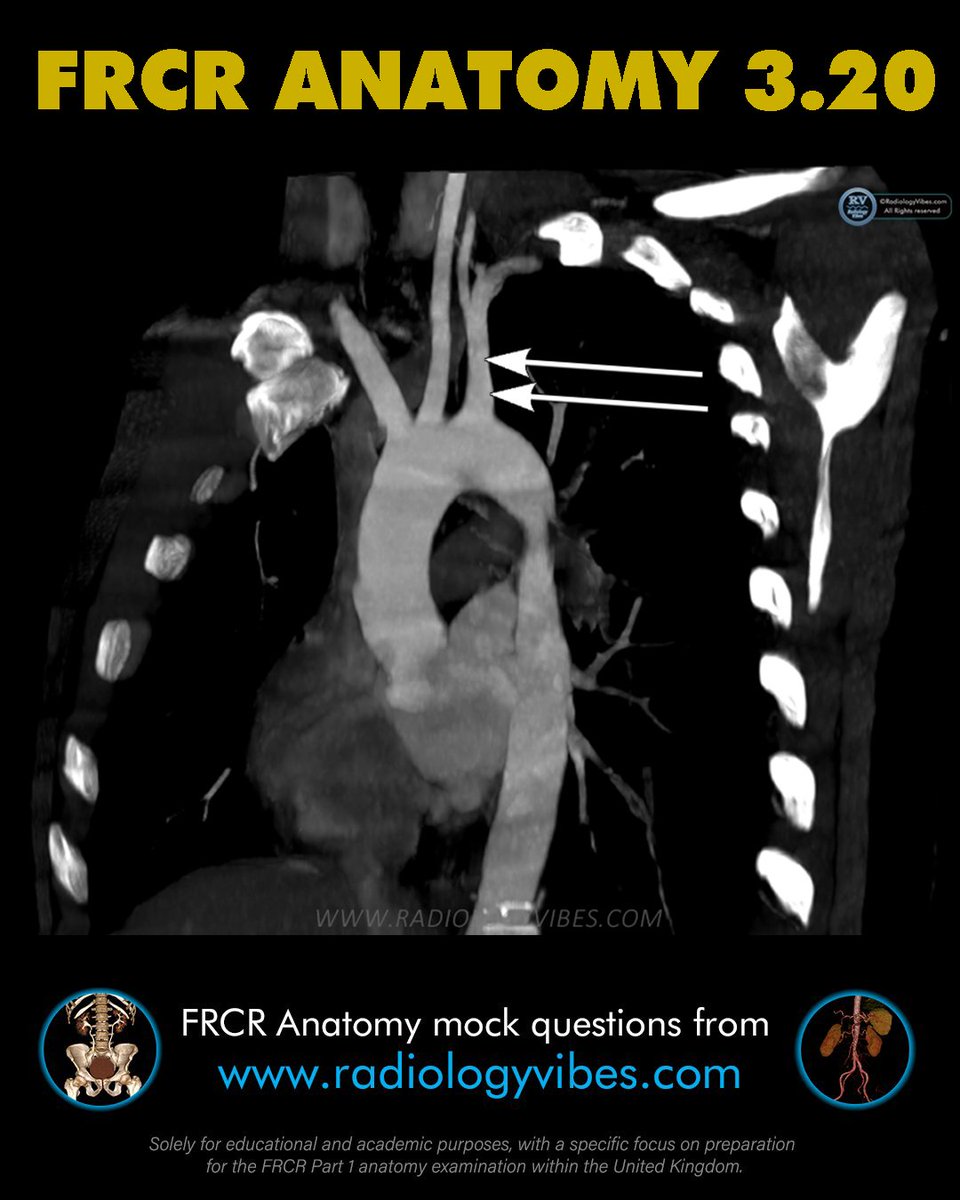 FRCR Anatomy 3.20: Name the arrowed structure #radres #FOAMrad #FRCR #radiology #anatomy #MedTwitter #radtwitter #FRCRanatomy @Radiology_Vibes @anatomy4frcr @_the_SRT