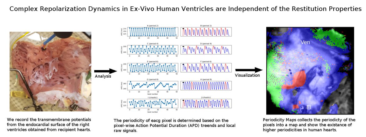 Neal Kumar Bhatia (@danealson) on Twitter photo Happy to share our work on mechanisms of VF in explanted human hearts. Thank you to <a href="/DrManiCTSurgery/">Mani A Daneshmand</a> for helping us with this endeavor. If you could also stop doing transplants at 3 AM, then I could get some sleep :-)
tinyurl.com/2rbcbtfj
<a href="/FaisalMMerchant/">Faisal Merchant</a> <a href="/melchami99/">Mikhael El-Chami</a> Happy to share our work on mechanisms of VF in explanted human hearts. Thank you to <a href="/DrManiCTSurgery/">Mani A Daneshmand</a> for helping us with this endeavor. If you could also stop doing transplants at 3 AM, then I could get some sleep :-)
tinyurl.com/2rbcbtfj
<a href="/FaisalMMerchant/">Faisal Merchant</a> <a href="/melchami99/">Mikhael El-Chami</a>