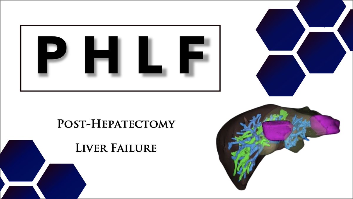🚨 🚨 🚨 🚨 🚨 🚨 🚨 Post-hepatectomy Liver failure (PHLF) - Dreaded complication of a difficult surgery Is there a unifying definition of PHLF? What are the preventive strategies? How best can it be managed? Lets dive right in! Bookmark this thread 🧵 #MedTwitter