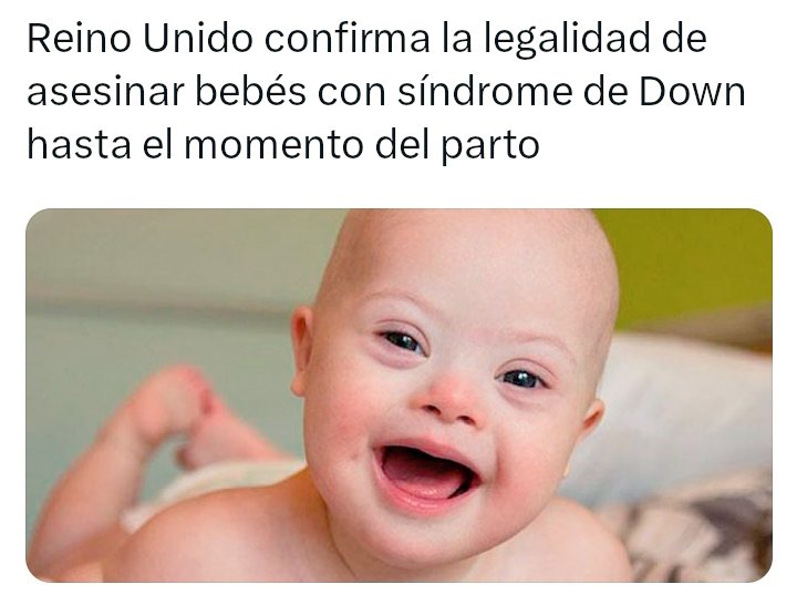 Sondeo Tuitero 

Está de acuerdo que asesinen a un bebé por nacer con síndrome de Down?

NO: 🔄
SÍ: ♥️
.
.