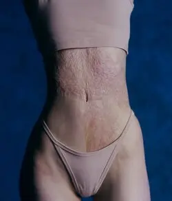 "Những vết sẹo trên làn da qua ống kính của Maria Raymers, một cái nhìn đầy tâm huyết và nghệ thuật."
#Raymers