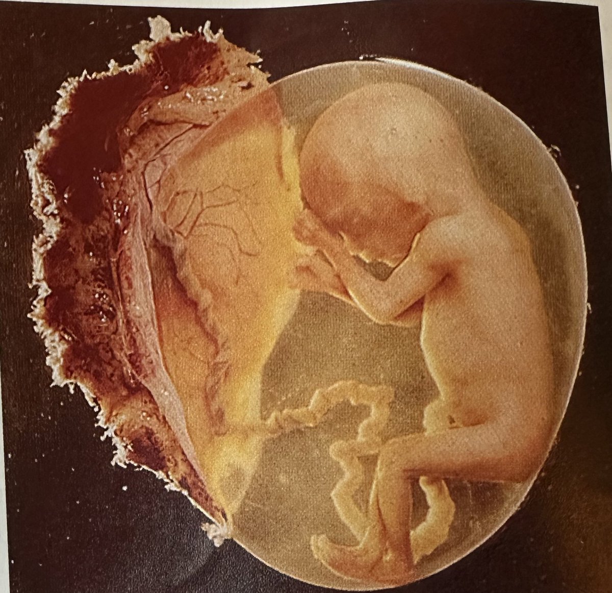 Prolife_Texan__'s tweet photo. Don’t tell me you believe all lives matter when you decide to put a milestone in front of it so you can freely cause the death of young human beings. #BeProLife https://t.co/QA9GYfyfjA