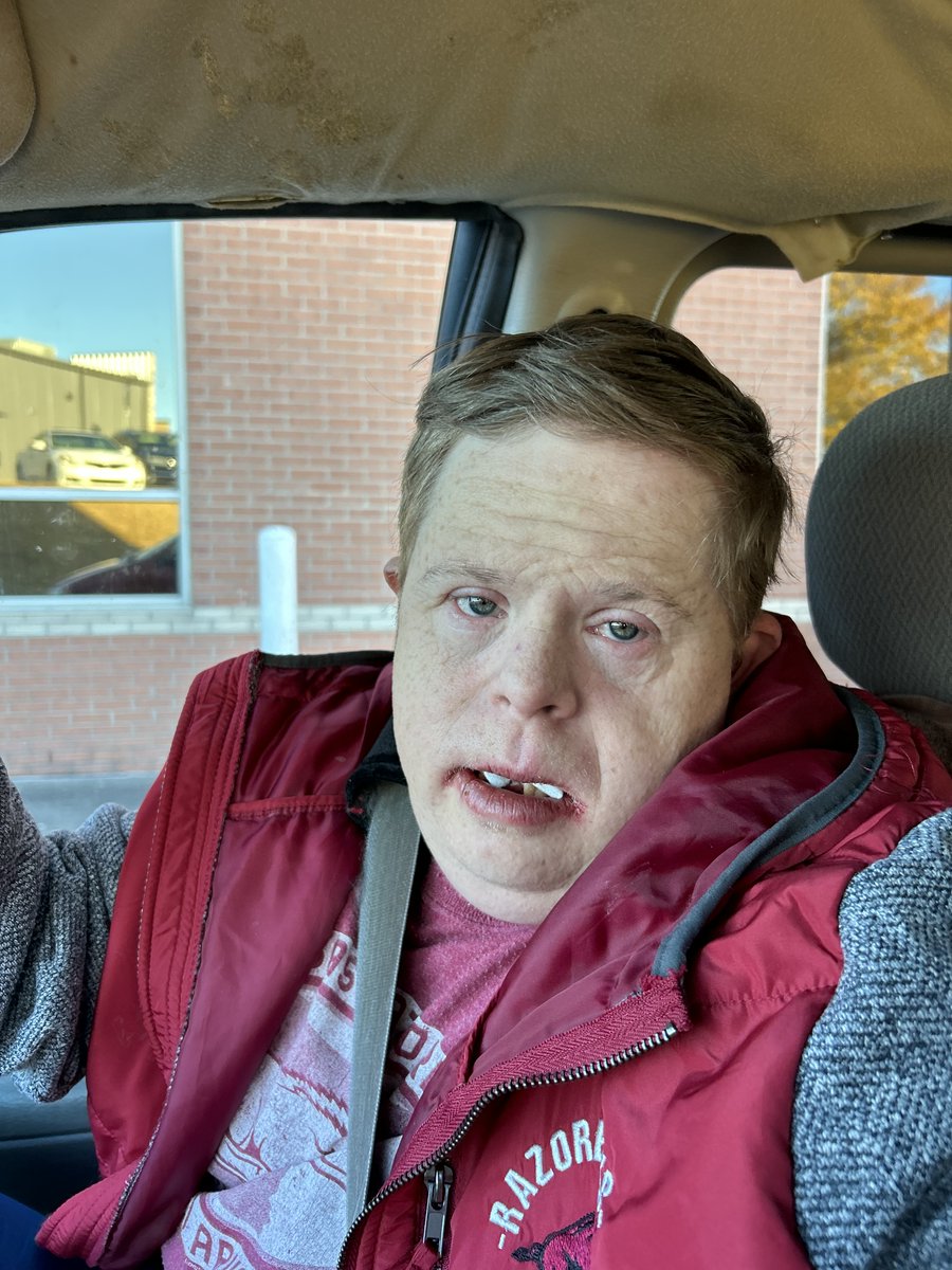 CanaanSandy's tweet photo. I M #WPS BETTER GUYS 🙌🏽 ORAL SURGERY WILL HELP ME GET WELL! 6 🥹🦷 #OutOfThere 👍🏽! THANK U #DRJAMESBATSON ! B BACK SOON @ArkRazorbacks! 🤟🏽U ALL! GO @RazorbackVB @RazorbackWBB @RazorbackMBB ! B 👀ING ! https://t.co/otXoBuqYlf