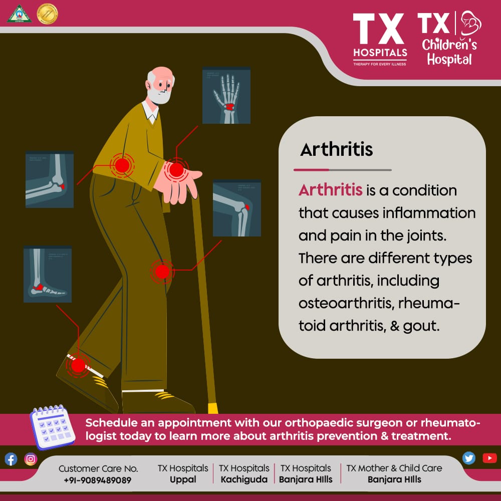 txhospitals's tweet image. 🦴 Joint pain? Act now! Consult our orthopaedic surgeon or rheumatologist for quick relief and expert guidance on arthritis prevention and treatment. 💪 #ArthritisHelp #JointCare

Book Now: txhospitals.in/specialities/o…
Call Now: +91-9089489089