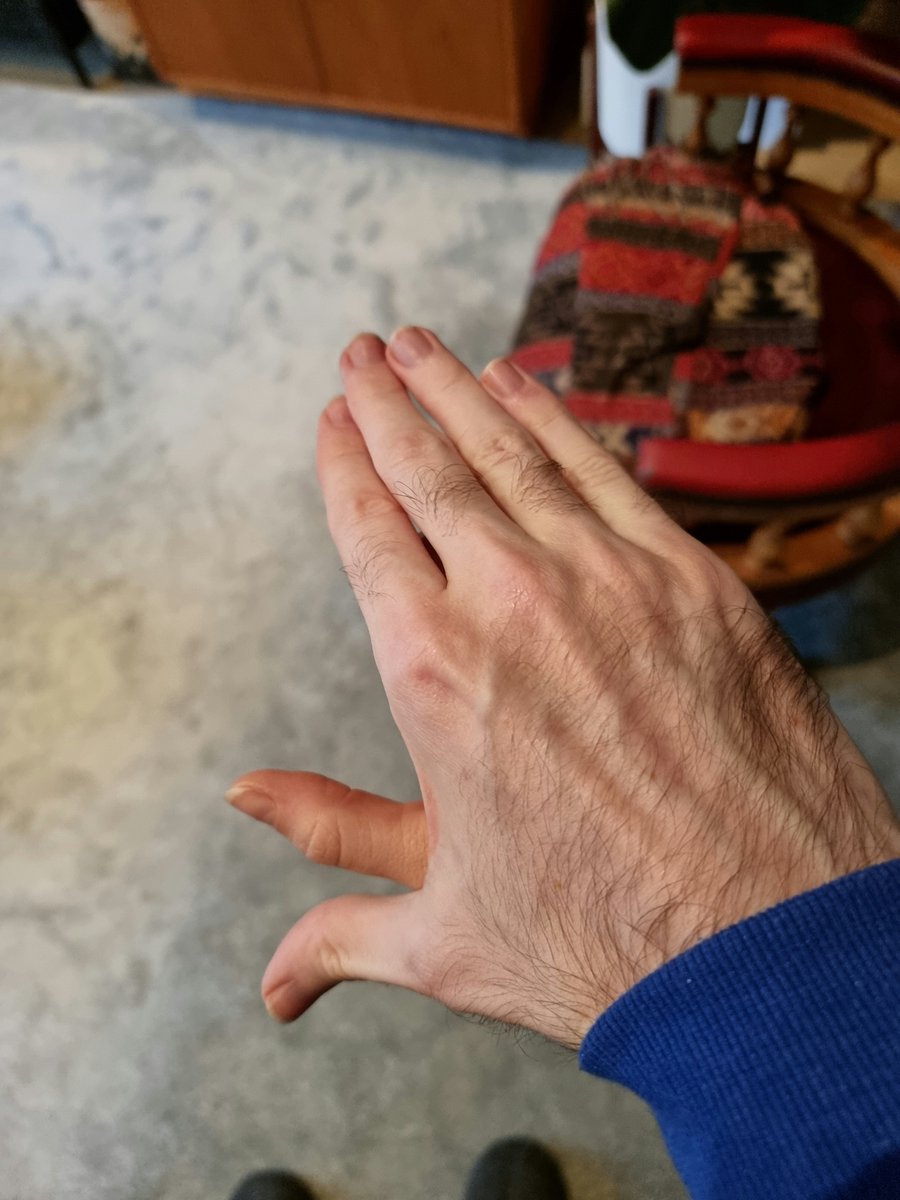 Davey Hackett tweet media