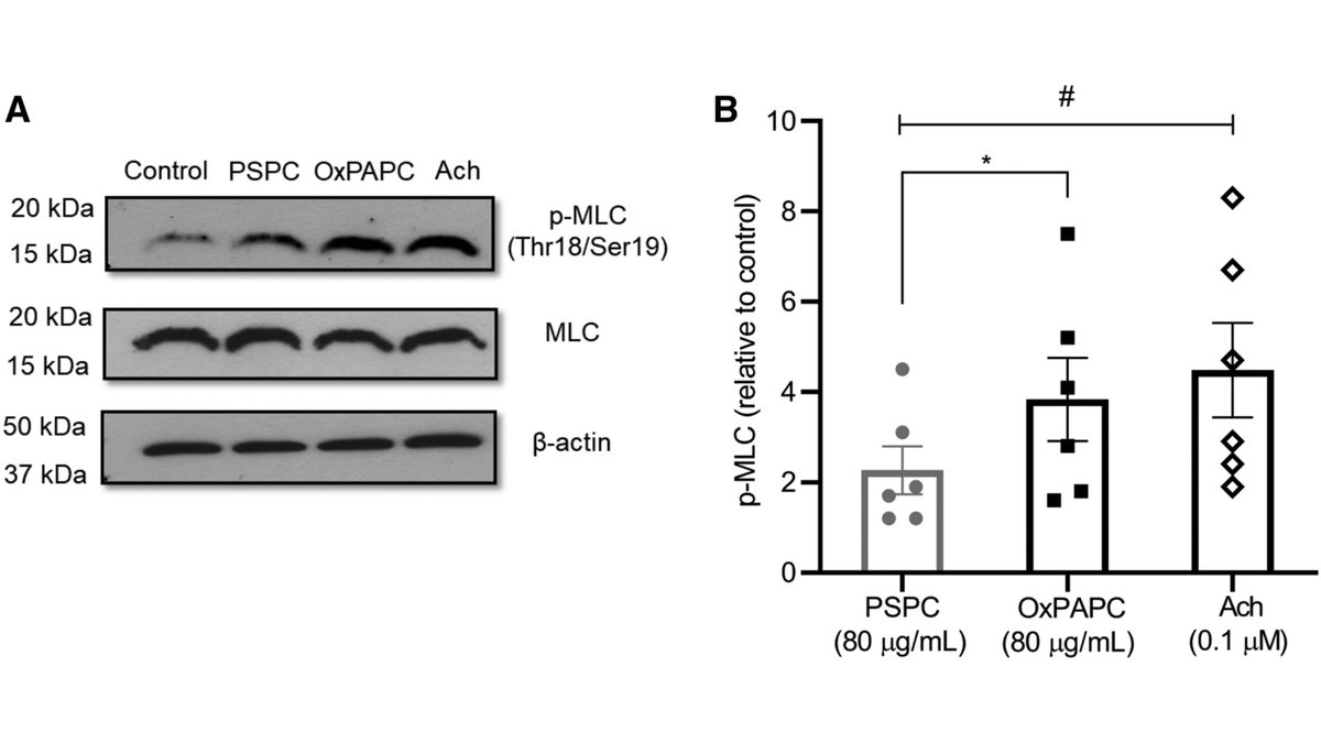 Oxidized Phosphatidylcholines Trigger TRPA1 and Ryanodine Receptor–dependent Airway Smooth Muscle Contraction 🔗 bit.ly/3RrEaXb