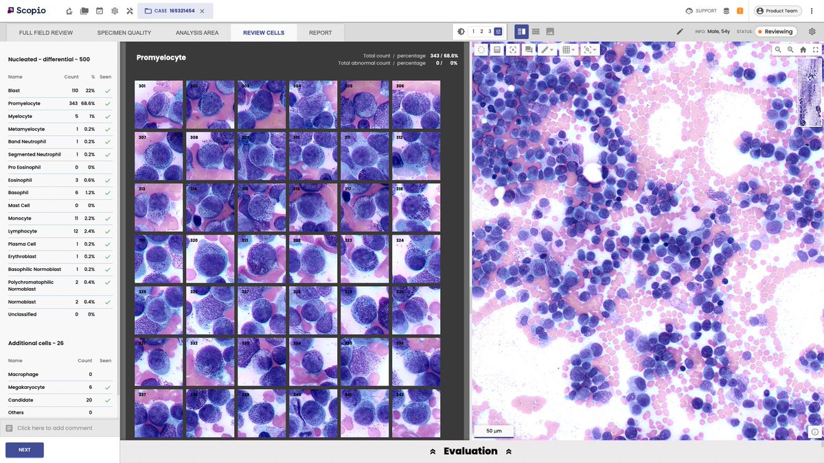 When tissue pathology reached the digital age, hematopathology and, specifically, bone marrow test procedures remained frustratingly analog, but that's all about to change... bit.ly/3GxVFyN