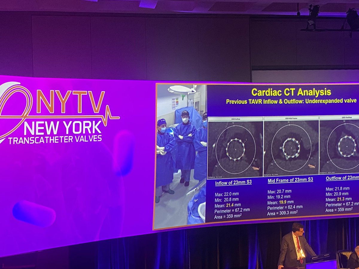 Live transcatheter valve cases in New York! 🫀🗽 @GilbertTangMD @NytvL @MountSinaiHeart