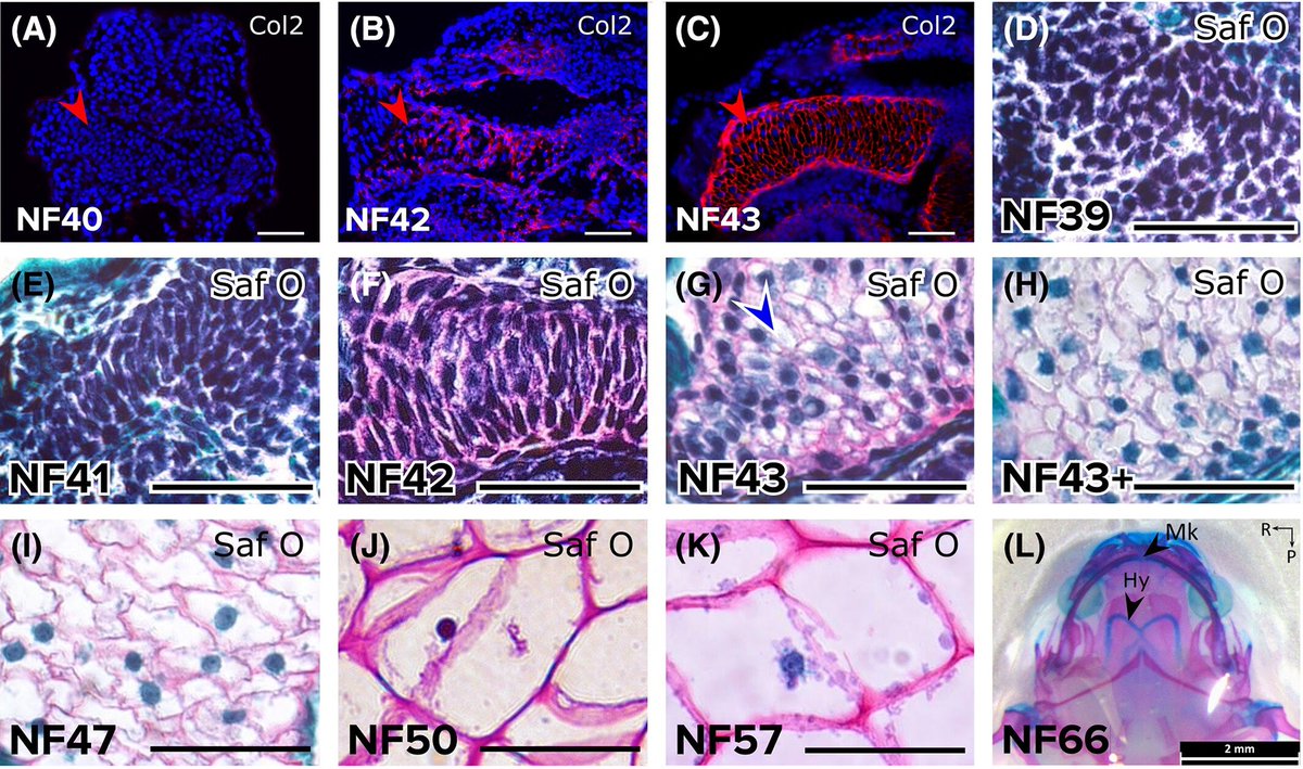 DevelopmentalDy's tweet image. #Cartilage maturation during #endochondral #ossification is considered a conserved process. Learn how deviations in this process in X. tropicalis especially in col10a1 expression, shed light on cartilage #evolution with #osteoarthritis health implications doi.org/10.1002/dvdy.5…