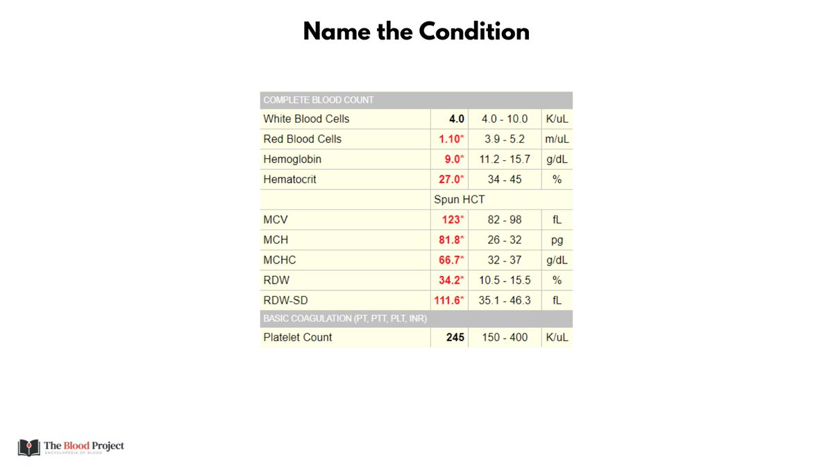 1/7 COLD AGGLUTIN DISEASE I tweeted an unknown CBC yesterday and asked for a diagnosis in 3 words. Many of you responded with the correct answer 👋: cold agglutinin disease.