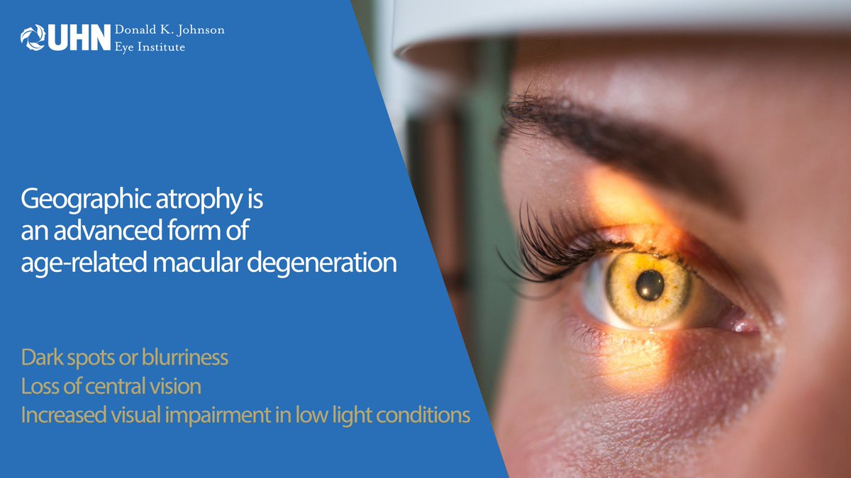 DKJEI_UHN's tweet photo. This week is #GeographicAtrophy (GA) Awareness Week!
GA is a progressive eye disease that can lead to permanent vision loss and blindness, and it affects over 5 million individuals worldwide.
Learn more: https://t.co/jDdLhpna5O
#GAAwarenessWeek https://t.co/krqEKd741B