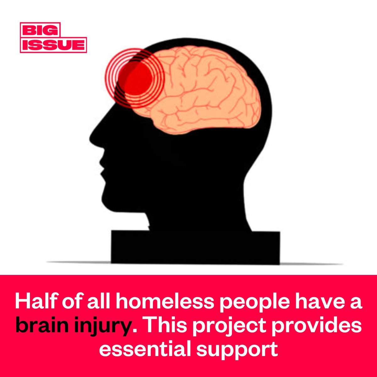 50% of the homeless population have sustained a head injury. 

Once experiencing homelessness, people are also five times more likely to go to hospital for a head injury. 

Here's how this project is helping ⬇️

bigissue.com/news/social-ju…