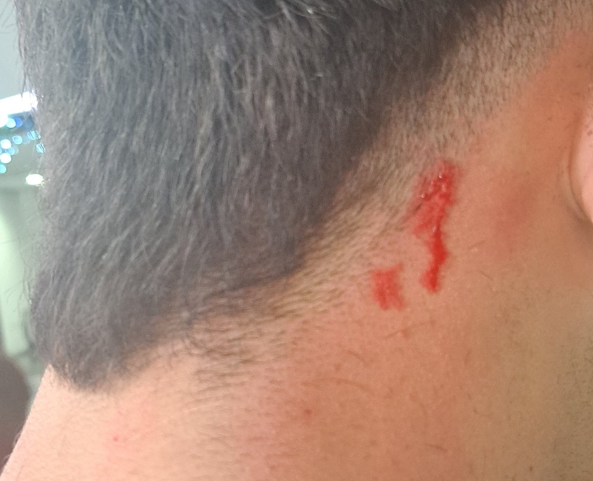 LlamameFede's tweet photo. poco más y la peluquera me decapita https://t.co/qDTqyA04u0
