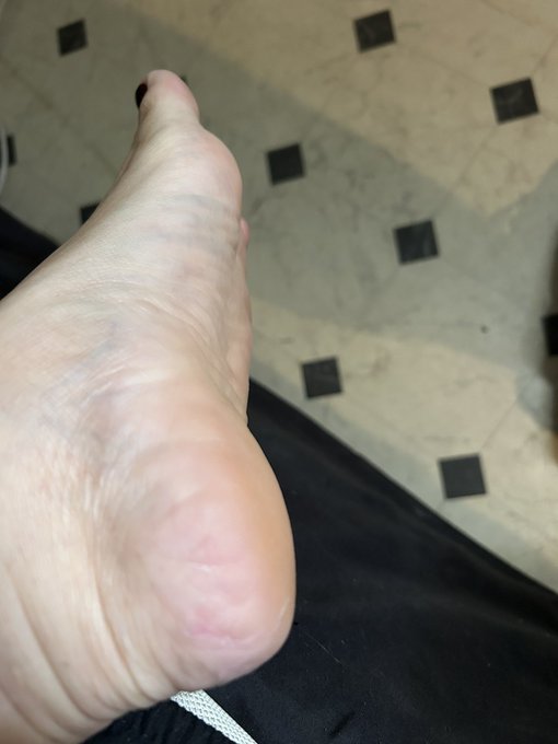 If you want to reimburse the tragic service I had at a pedicure salon it would be amazing 😭😭😭😭  I came