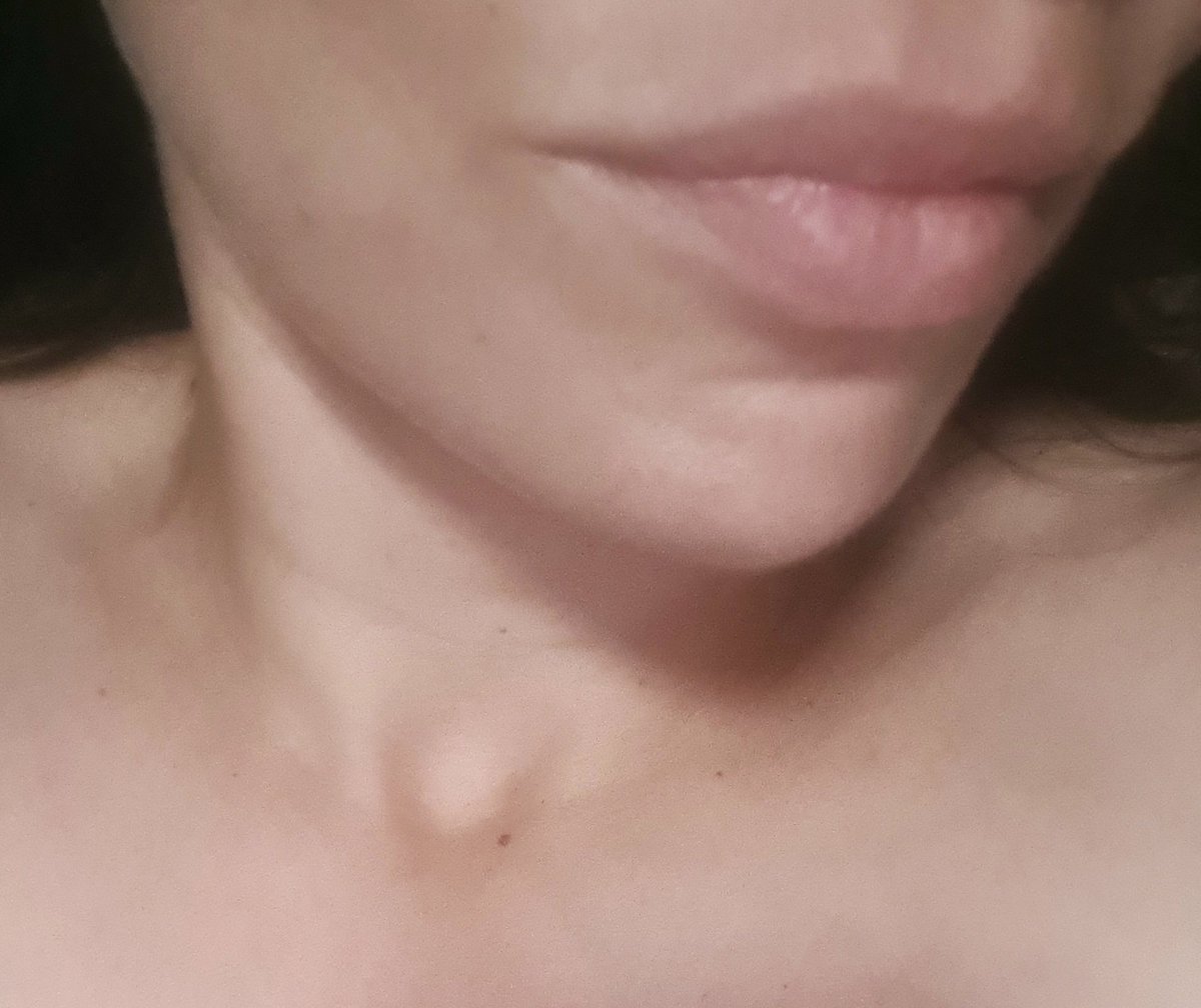 הליידי tweet media