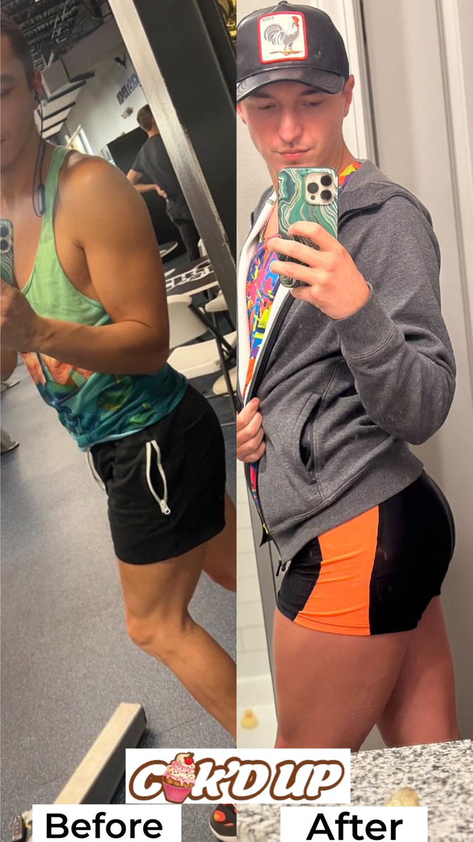 Wecakdupstore's tweet image. Progress is key, our ambassador Andrew took his dedication to the gym and chose CAK’D UP as his secret to bigger gains 🍑. We love to see amazing progress like this! All natural results! 🍃

Link in bio to purchase. #cakdup #glutebuilding