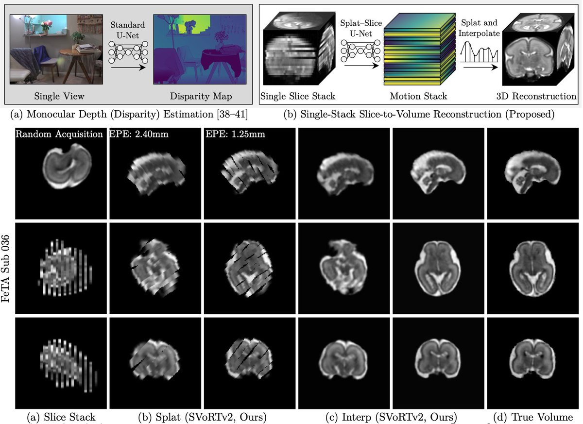 New preprint on Fully Convolutional Slice-to-Volume Reconstruction for Single-Stack MRI arxiv.org/abs/2312.03102 Following recent single-view depth estimation methods, it produces SOTA reconstructions even with extreme inter-slice motion, eg fetal MR Work spearheaded by Sean Young