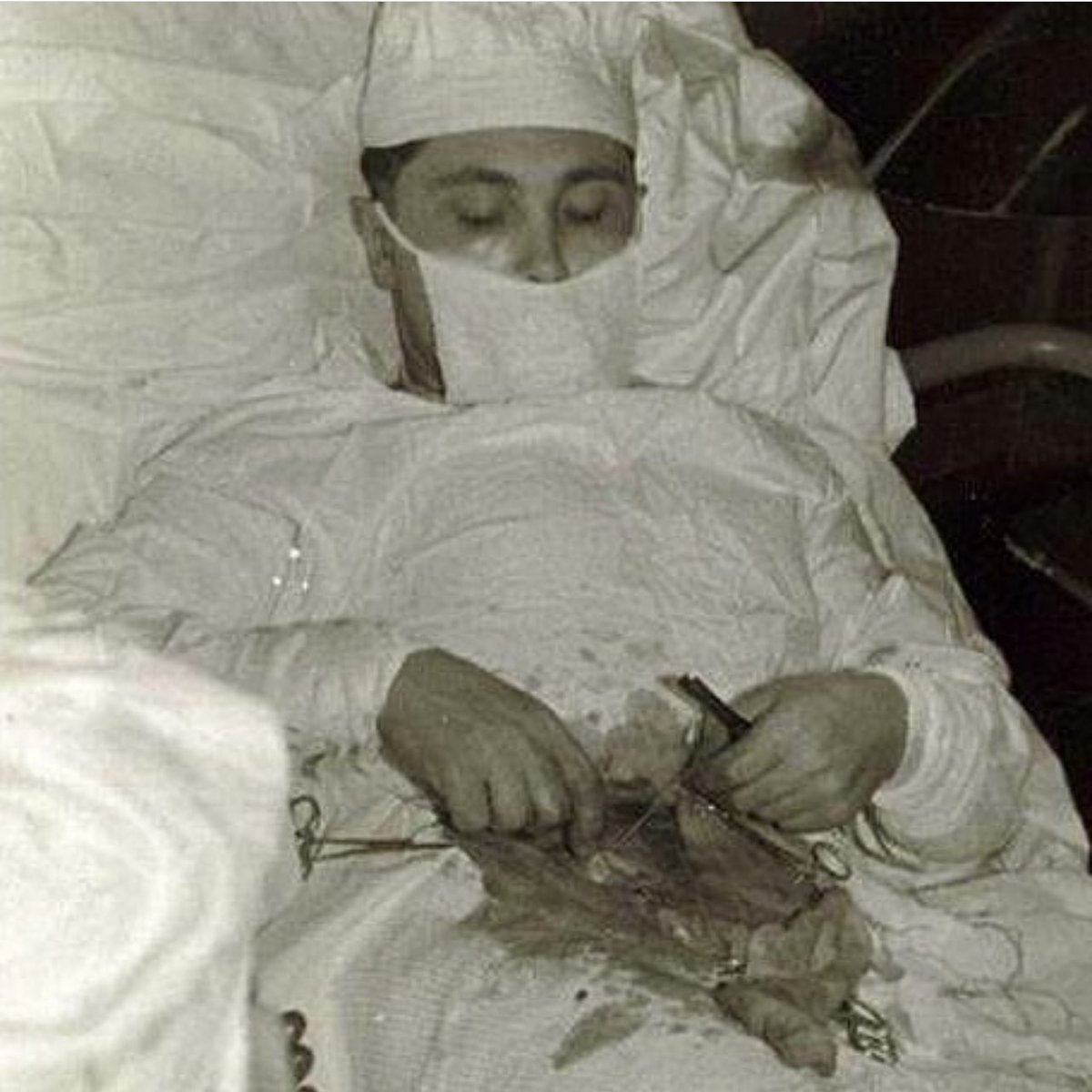 اضطر الطبيب السوفييتي ليونيد روجوزوف إلى اجراء جراحة عاجلة على نفسه لاستئصال الزائدة الدودية عام 1961، حيث كان الطبيب الوحيد على متن محطة أبحاث روسية في وسط القارة القطبية الجنوبية