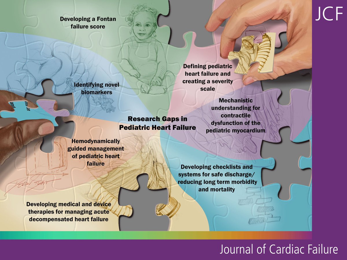 Research gaps in #pediatric #heart failure identified by an international all ⭐️ #heartfailure crew including trainees ! Important for all researchers and funding agencies 🙏 @JCardFail onlinejcf.com/article/S1071-… @CleClinicHVTI