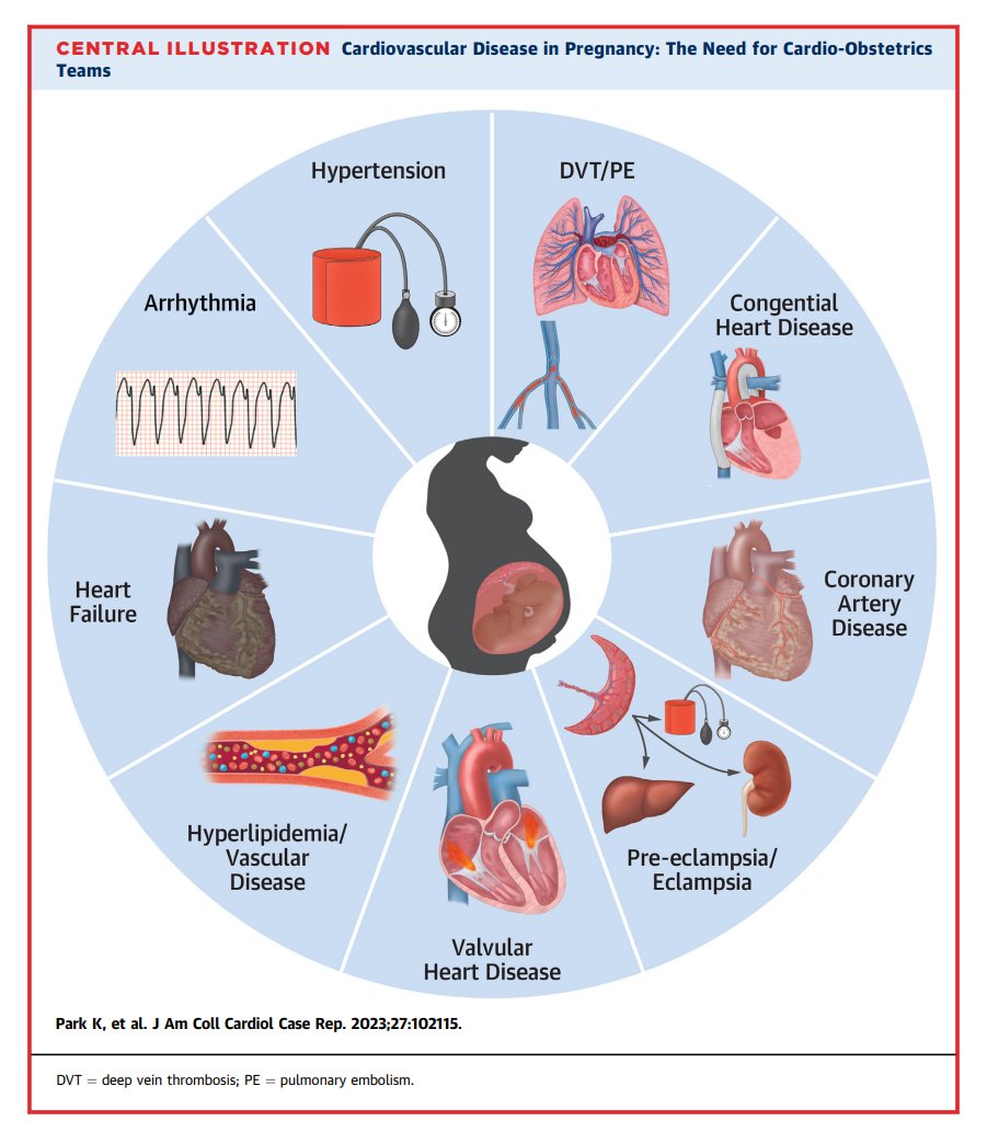 Cardio-Obstetrics: A Blueprint for Improving Maternal Cardiovascular Health Across the Life Course | JACC: Case Reports jacc.org/doi/10.1016/j.… Thanks to @cardioPCImom and @nataliebello9 for this great guest editor's page! #JACCCaseReports @JACCJournals #CardioObstetrics