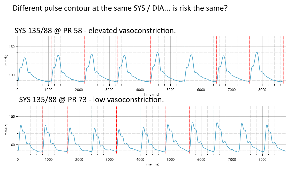 doingnz's tweet photo. @DrMarthaGulati @ASPCardio @DBelardoMD @a_l_bailey @FaRodriguezMD @DrMichaelShapir @pnatarajanmd @mchonig @dramitkhera @dmljmd @rblument1 @SethShayMartin @PamTaubMD @ErinMichos @AnumSaeedMD Is #ASPC2024 a large conference?
Would attendees be interested in @Uscom BP+ dual BP & PWA monitor to measure subclinical differences in CV healt? Achieve #CVDPrev by earlier intervention before vascular remodeling, CKD, .... ? Adherence? Titration? https://t.co/W1Pu8Rs8JJ