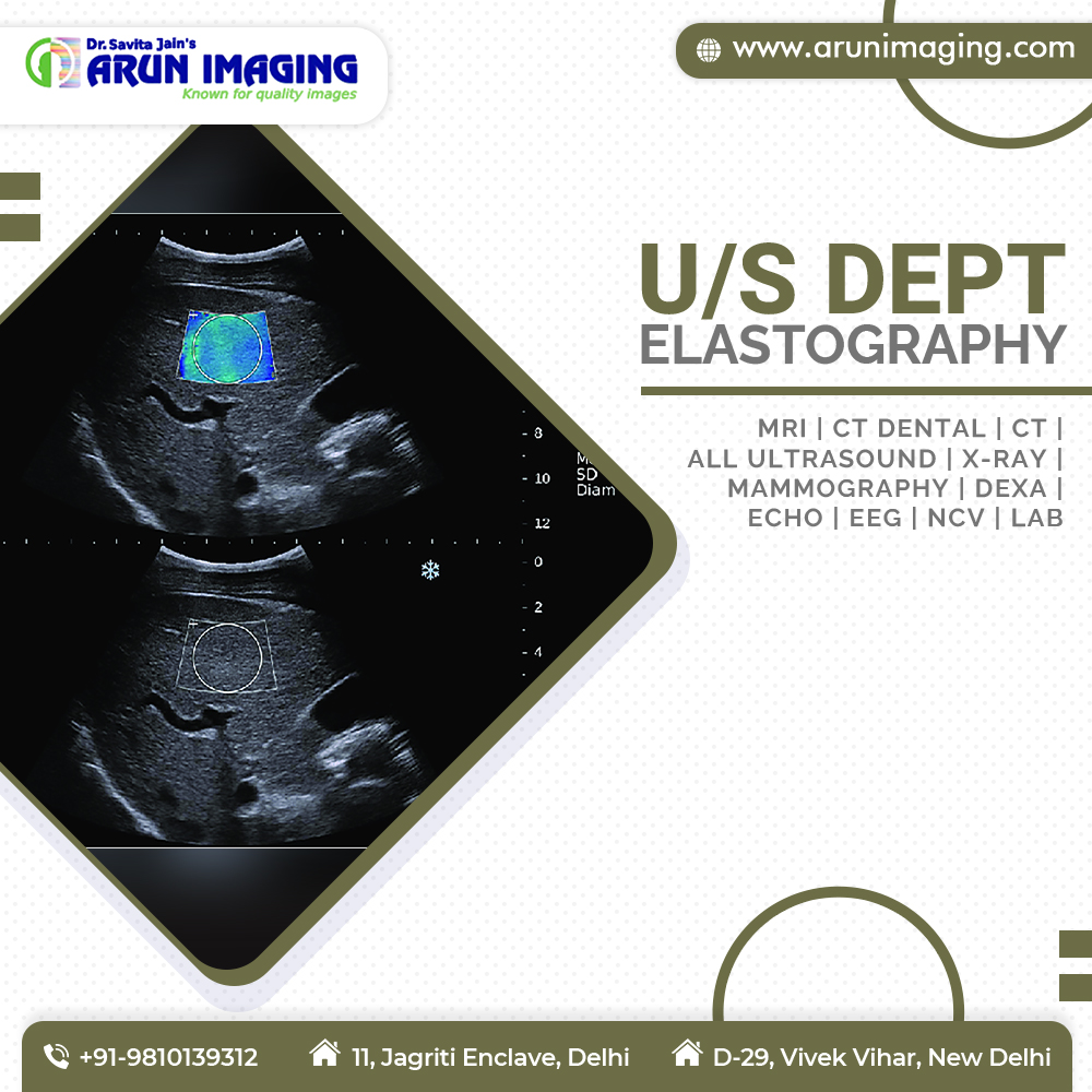 Searching for Elastography in Delhi? Book your appointment today: +91-9810139312. Elastography uses low-frequency vibrations during an ultrasound to measure the elasticity of organs inside the body. It is particularly useful for detecting the presence & severity of liver disease