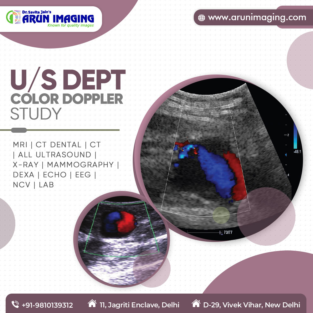 We are a renowned centre in Delhi providing Color Doppler Ultrasound Test in Delhi. Book your appointment today with us. Call Us: +91-9810139312 Book Appointment: arunimaging.com