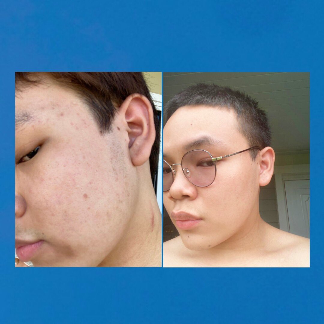 vimoreskin tweet picture