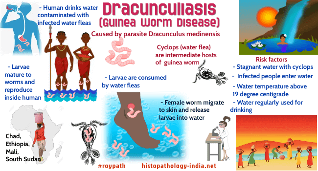 schowardjd's tweet photo. @neuralconsult Dracunculiasis (Guinea worm disease)

[image source: @DrSampyRoy, #RoyPath,  https://t.co/1P7EnR1PKx] https://t.co/bprVI9Is6r