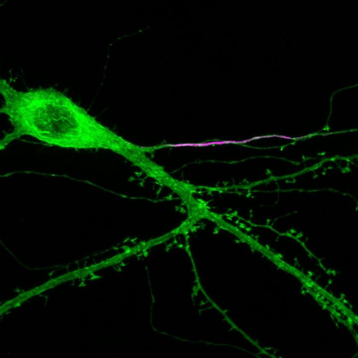 Ccultured hippocampal dentate granule cell, expressing the optogenetic tool channelrhodopsin-YFP cell-wide (green), and immunostained for the master AIS organising molecule ankyrin-G (magenta).

Credits: Mark Evans

#MedTwitter #neuroscience
