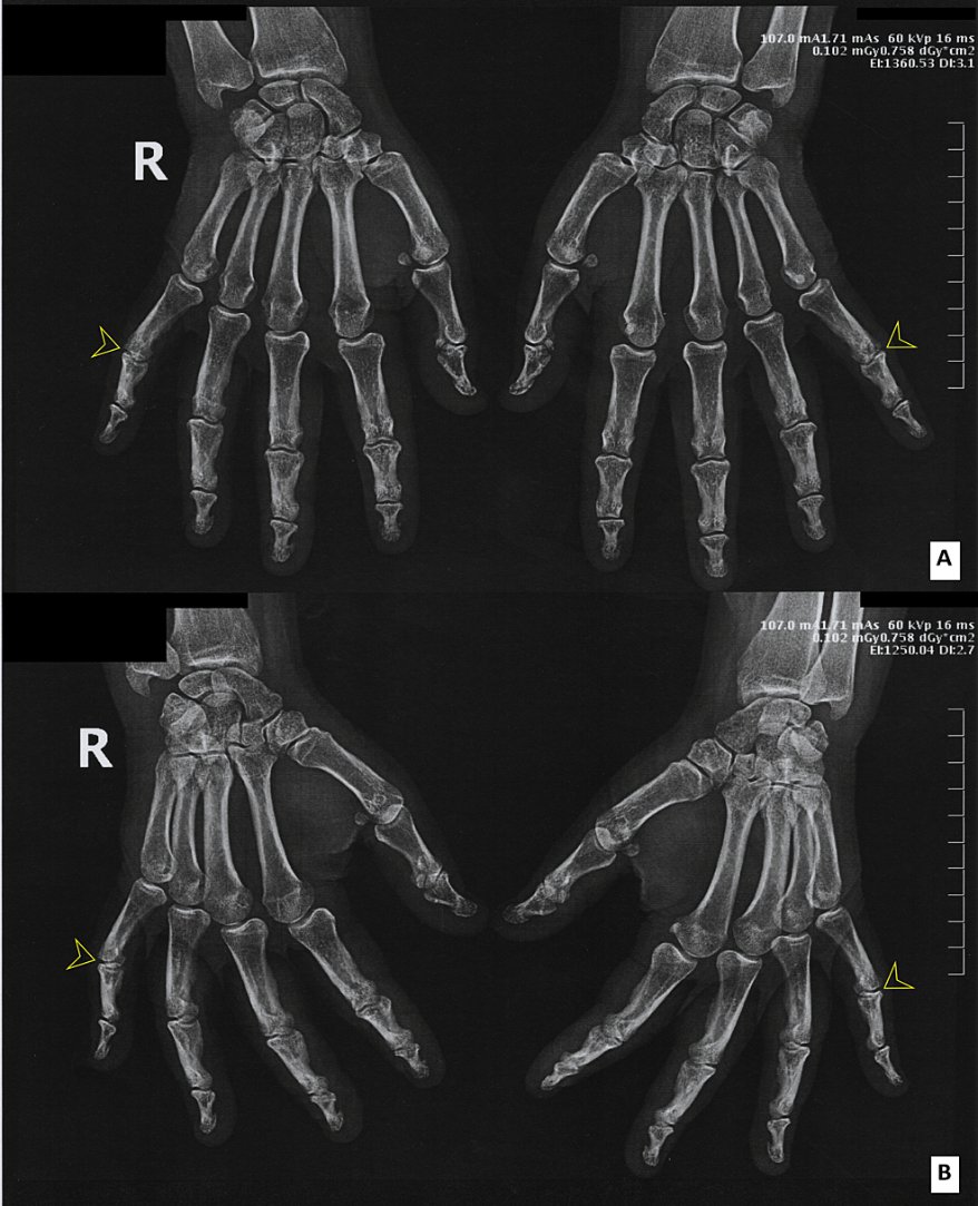 VaccineMole tweet picture