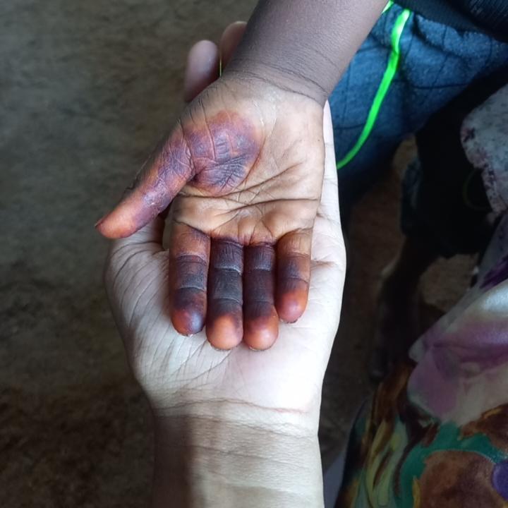 This is Ahmed. He can't sleep because he's scared the rsf will come to his house at night. His mom tries to keep him distracted with henna. Children in #Sudan are terrified. They don't understand what's going on. All they know is that they should be afraid #KeepEyesOnSudan