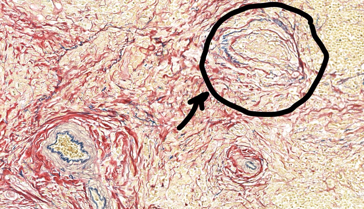 Tim Bracey tweet media