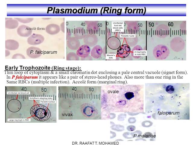 Ex-vivo short-term culture and developmental assessment of Plasmodium vivax